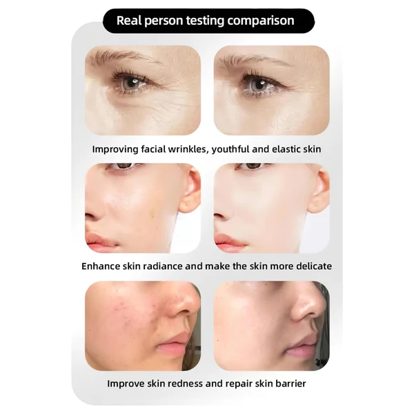 Photon Rejuvenation Arcápoló LED maszk